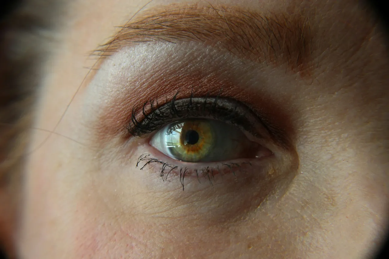 Kontakt lens